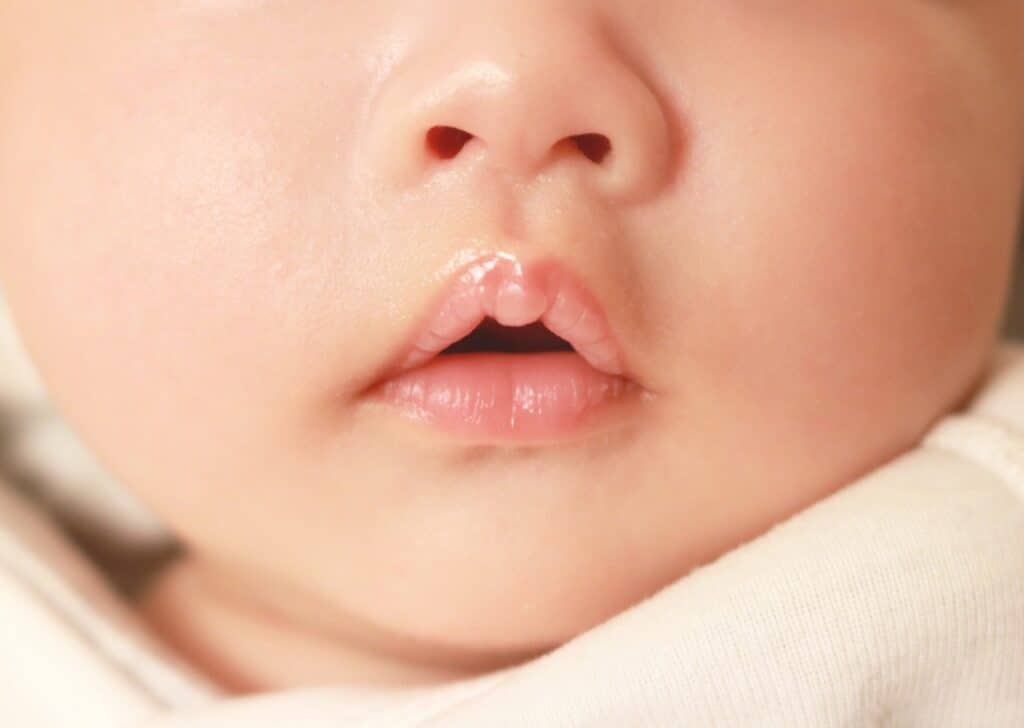 新生児のくしゃみの原因①鼻の穴が狭く鼻毛がない