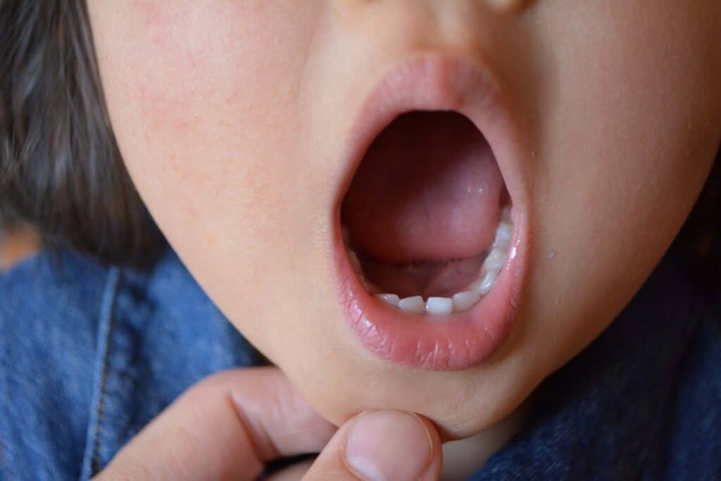 歯科医監修 虫歯のリスクは3歳までに決まる 指しゃぶりは歯並びに影響する 子供の歯に関するq A はいチーズ Clip