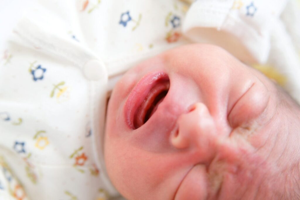赤ちゃんの吸いだこの原因や対処法は 痛みはないの はいチーズ Clip